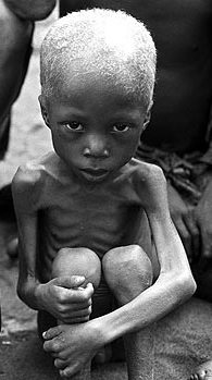 african children starving